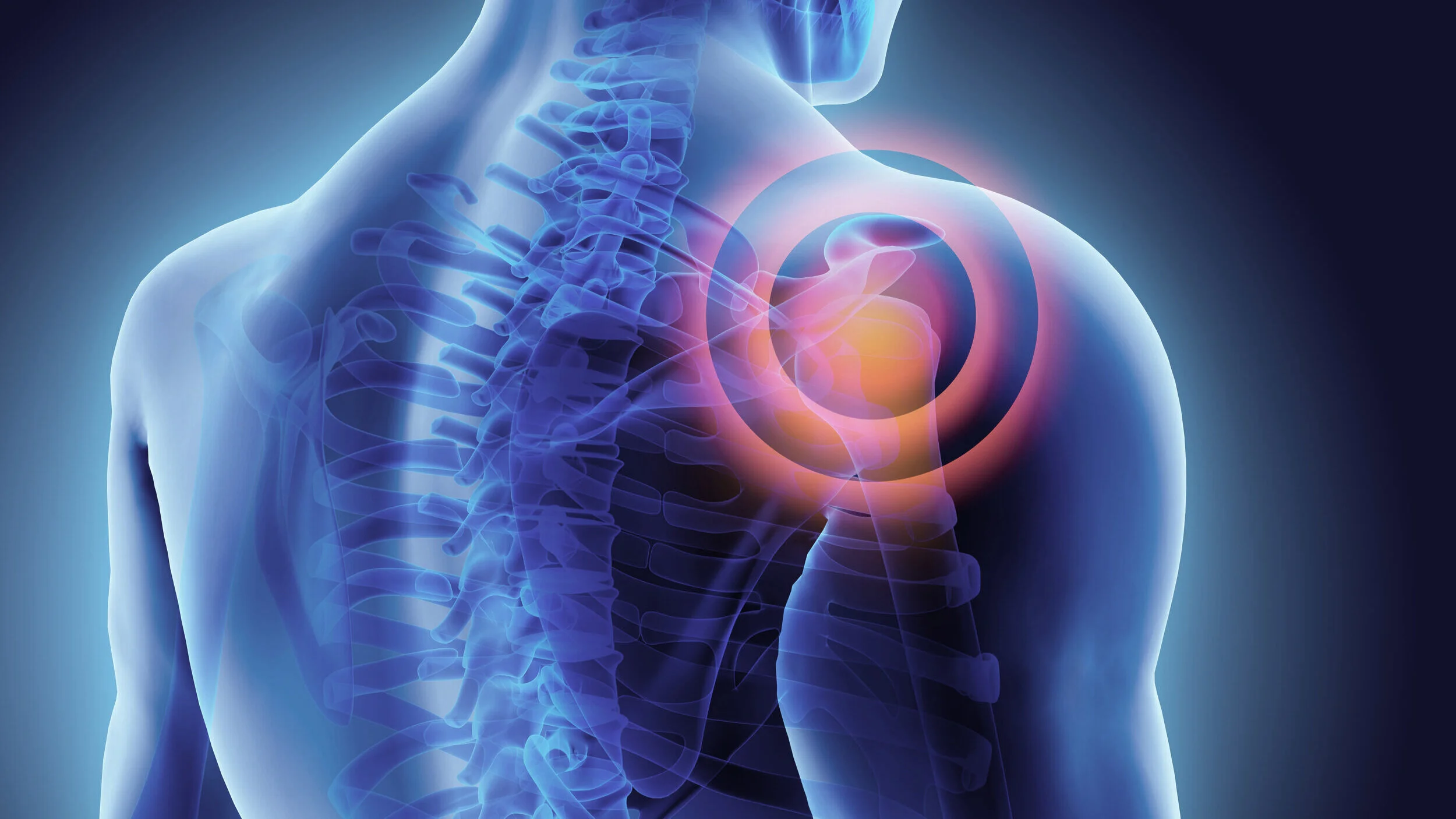 arthroscopic-capsular-release