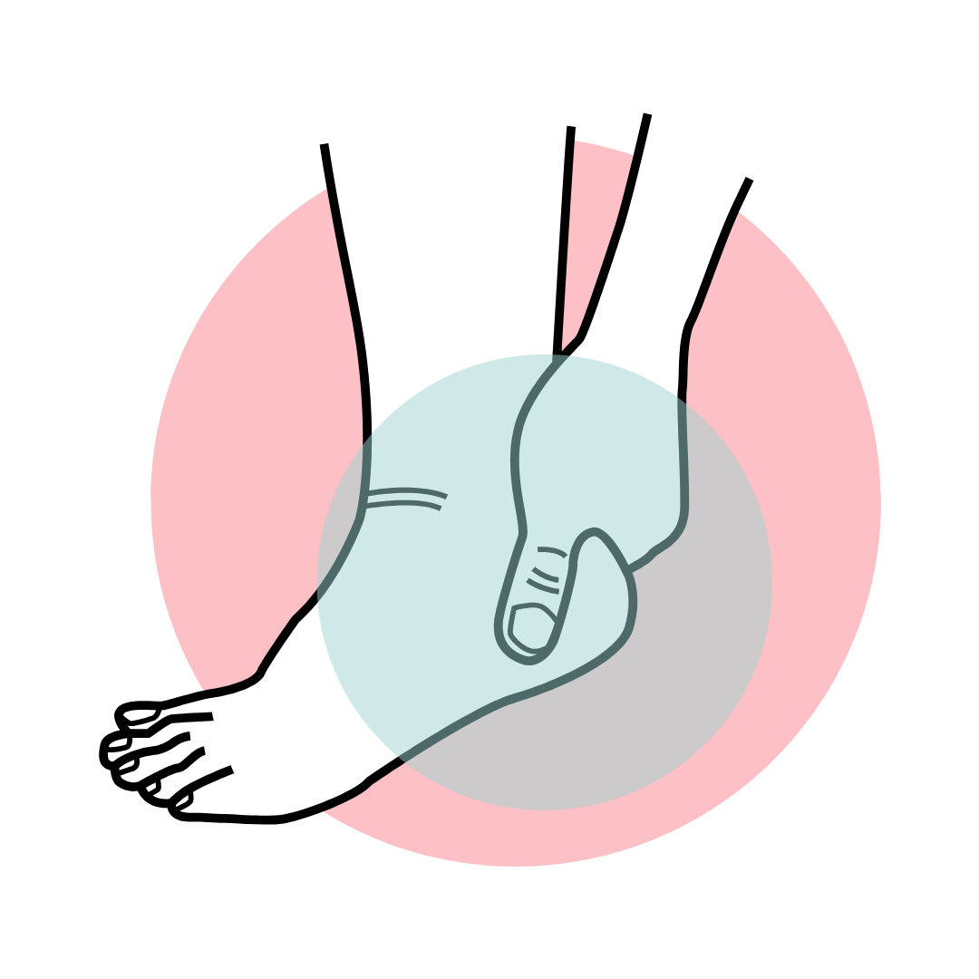 Plantar Fasciitis