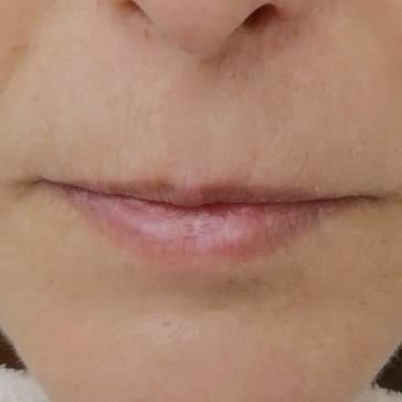 Before