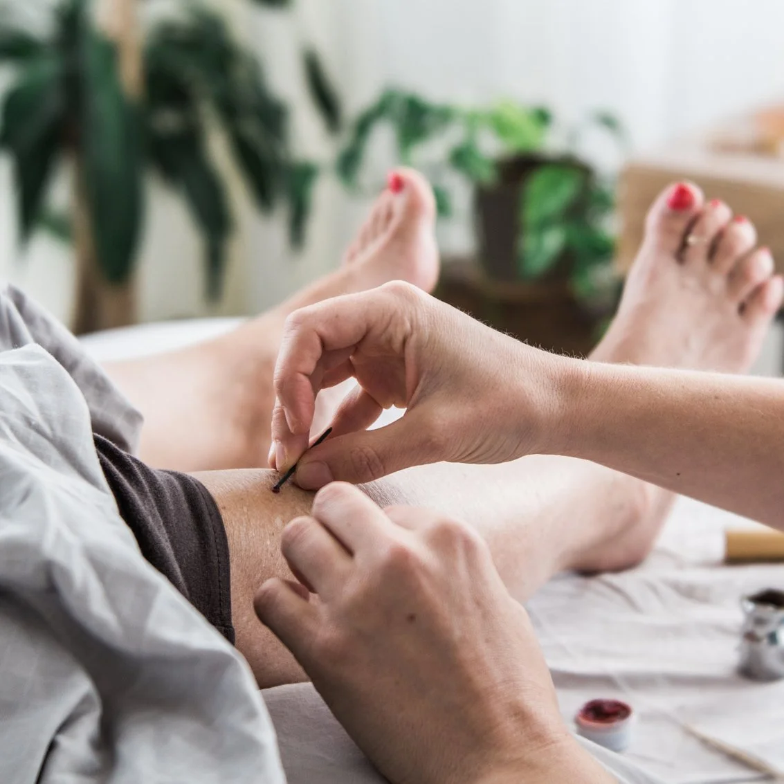 How to become a remarkable acupuncturist