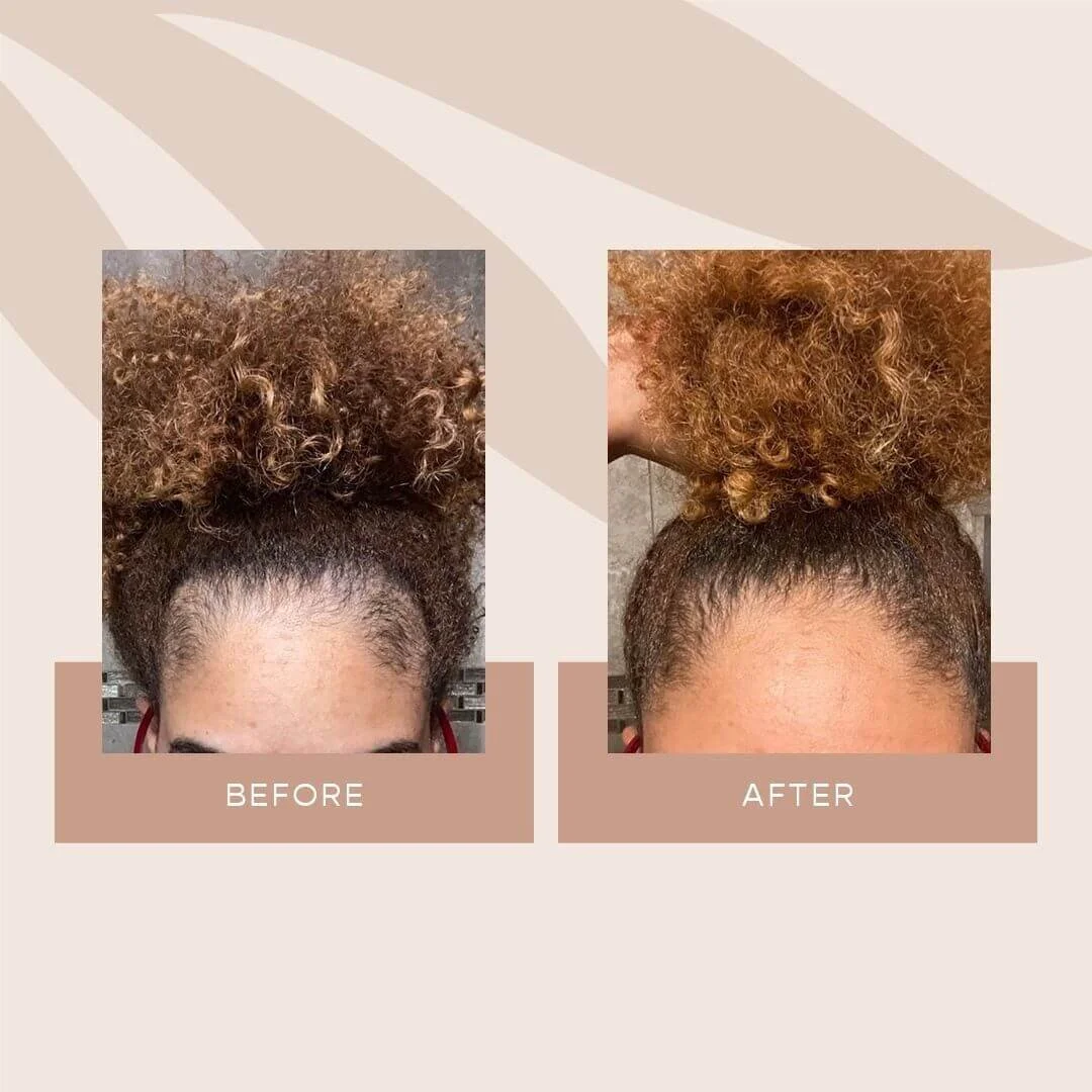 Results from using VEGAMOUR’s GRO+ Advanced Hair Serum
