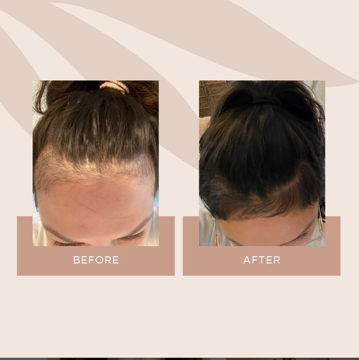 VEGAMOUR GRO Hair Serum - Before & After