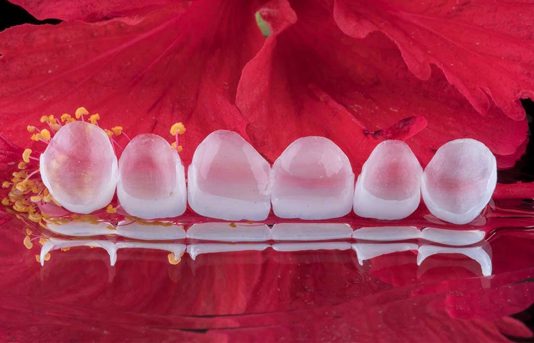 Porcelain Veneers Beverly Hills - Best Cosmetic Dentist Beverly Hills