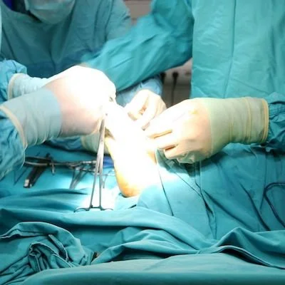 Taking Steps To Avoid Diabetic Amputation