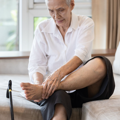 Osteoarthritis is a Painful Podiatric Problem
