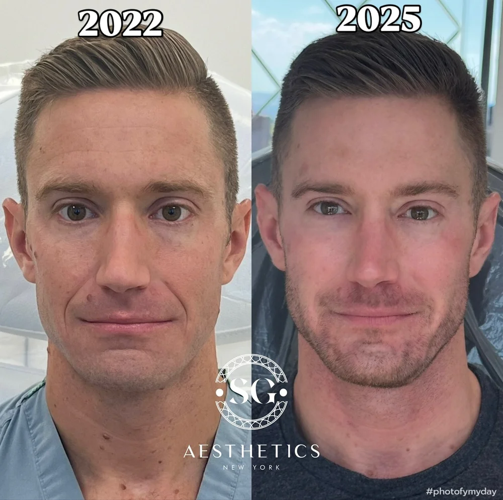 Real SG Aesthetics client result