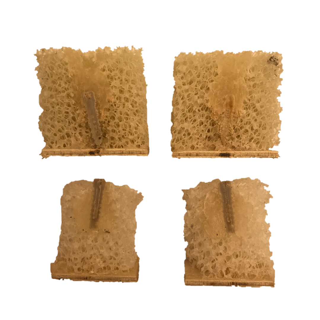 Injection through anchor into bone model