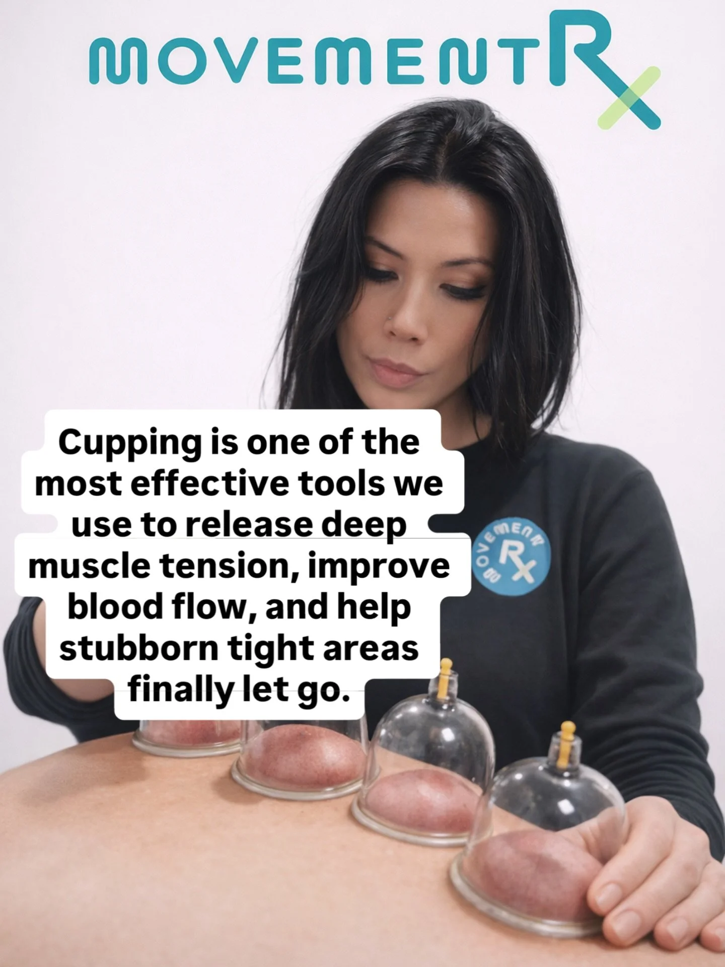 Why we love cupping at Movement RX

Cupping is one of the most effective tools we use to release deep muscle tension, improve blood flow, and help stubborn tight areas finally let go.

It&rsquo;s not just about the marks &mdash; it&rsquo;s about crea