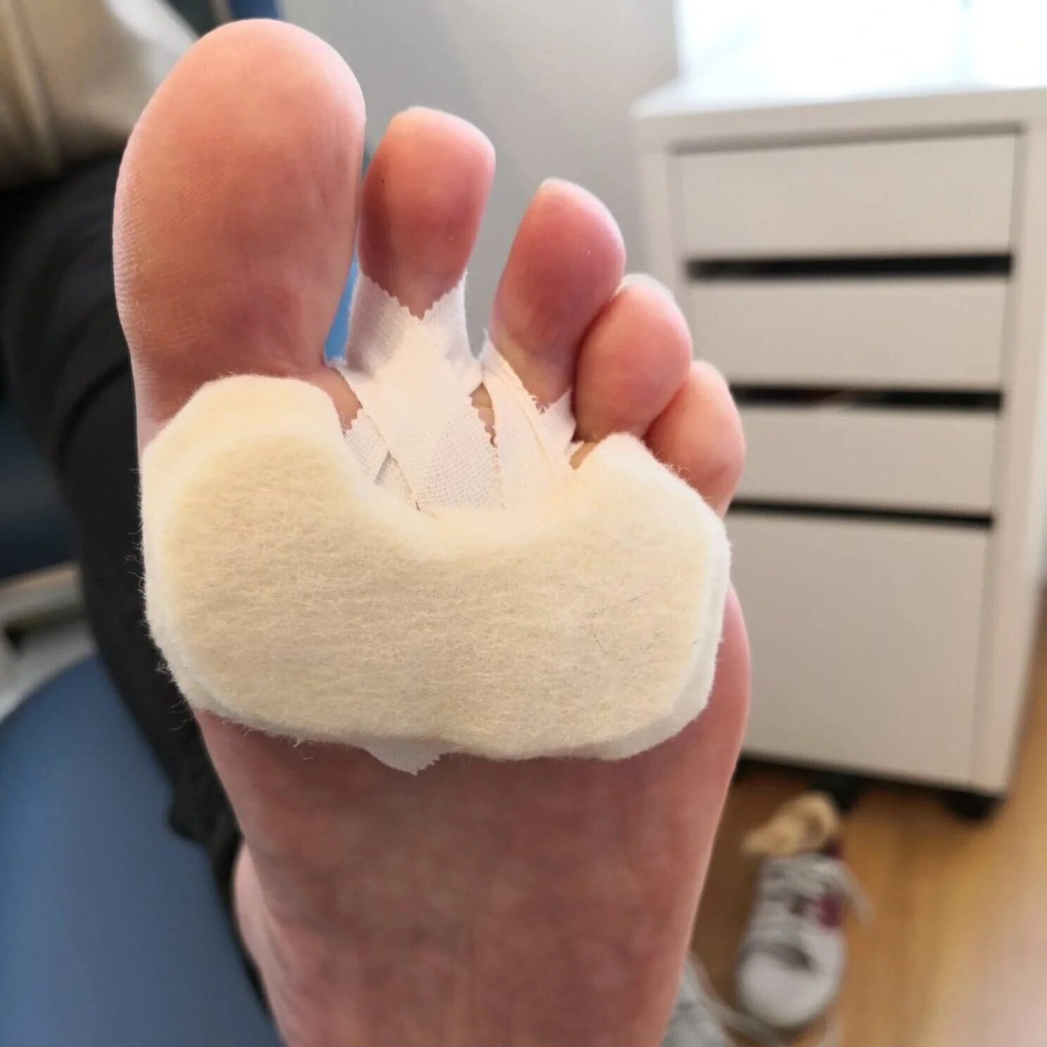 Plantar Plate Injury Foot Ankle Specialists In Kelso Tweed Podiatry