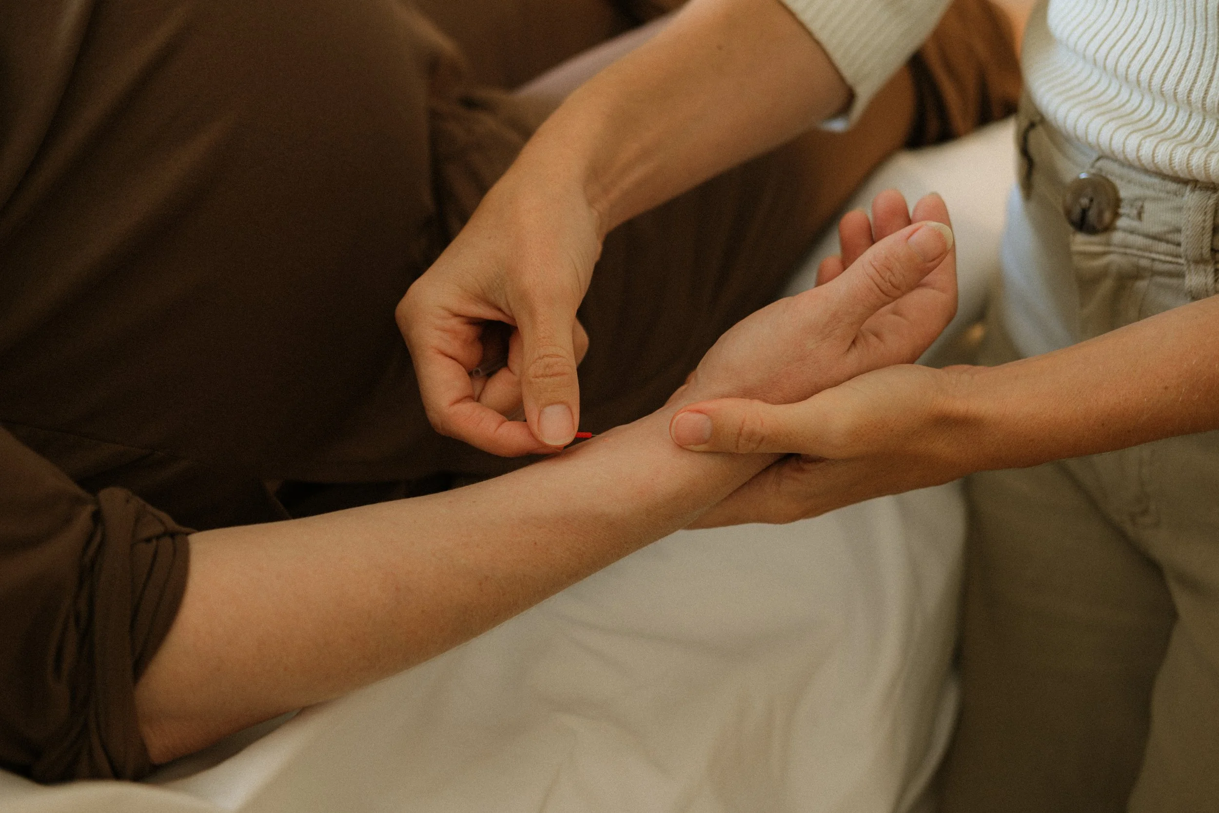 acupuncture_bon_air_midlothian_richmond_virginia