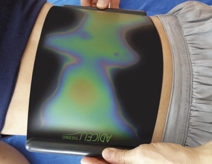 Contact Thermography: What’s Under the Skin | Cryo Generation