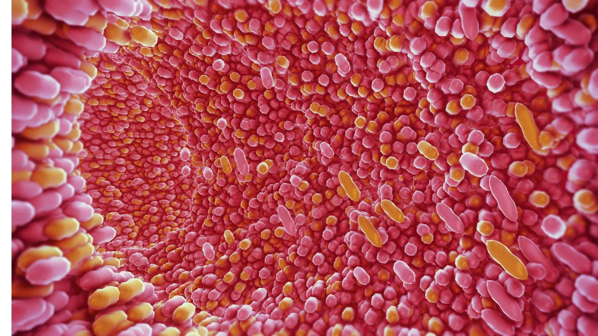 What in the World is SIBO? — Pelvic Floor Physical Therapy