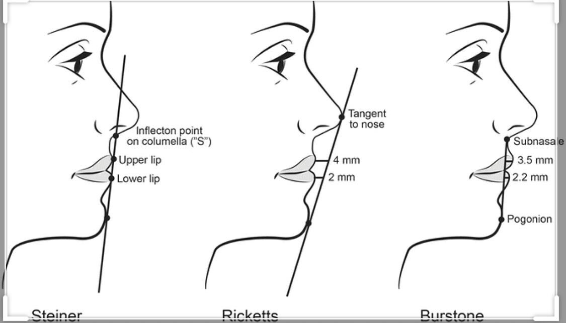 How does your chin measure up? Here&rsquo;s a few measurement techniques I use to determine if you&rsquo;re a good candidate for chin augmentation. Chin filler lasts around year, sometimes longer if you put #toxin in the mentalis muscle. It&rsquo;s r