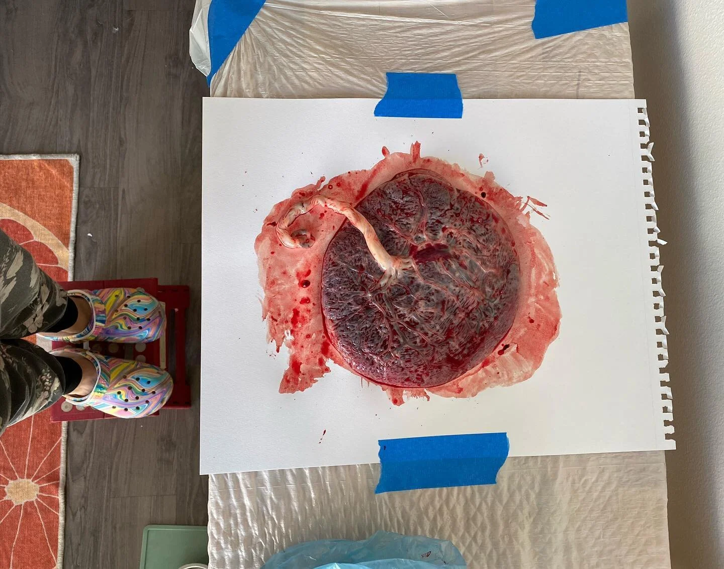 people who make placentas are PRETTY COOL ✨did you know placentas are as unique to each baby as your fingerprint? they range in size, cord length and if you get to feel the fetal side you can tell a lot about just by touching for calcifications and h
