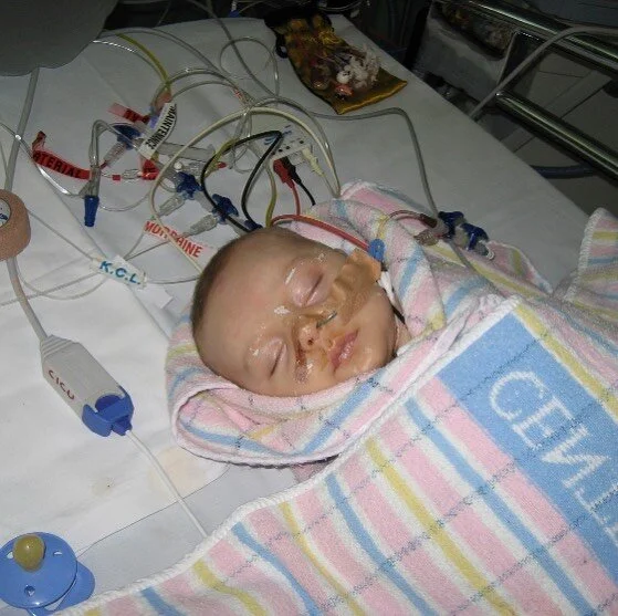 This is tiny little Archie after his first heart surgery. This week we heard from his Cardiologist to say, &lsquo;the AliveCor devices have been extremely useful. We have had such a large uptake of the devices that we will need to buy another consignment&rsquo;. @hearts4arch has now raised over $15,000 which equals about 75 devices. That&rsquo;s 75 little ones like Archie having a better chance at a full and healthy life. 💛 #sydneychildrenshospital #heartkids
