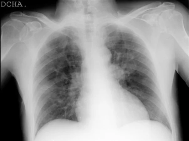 Midrc Covidx Challenge Midrc