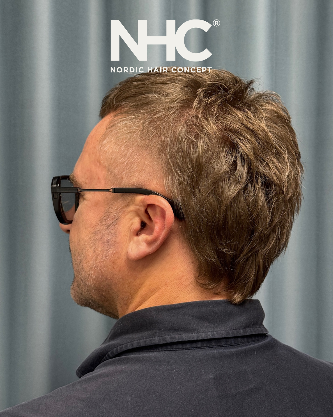 Profil af en mand med kort, let krøllet hår og solbriller, mod en grå baggrund, med logoet 'NORDIC HAIR CONCEPT' øverst.