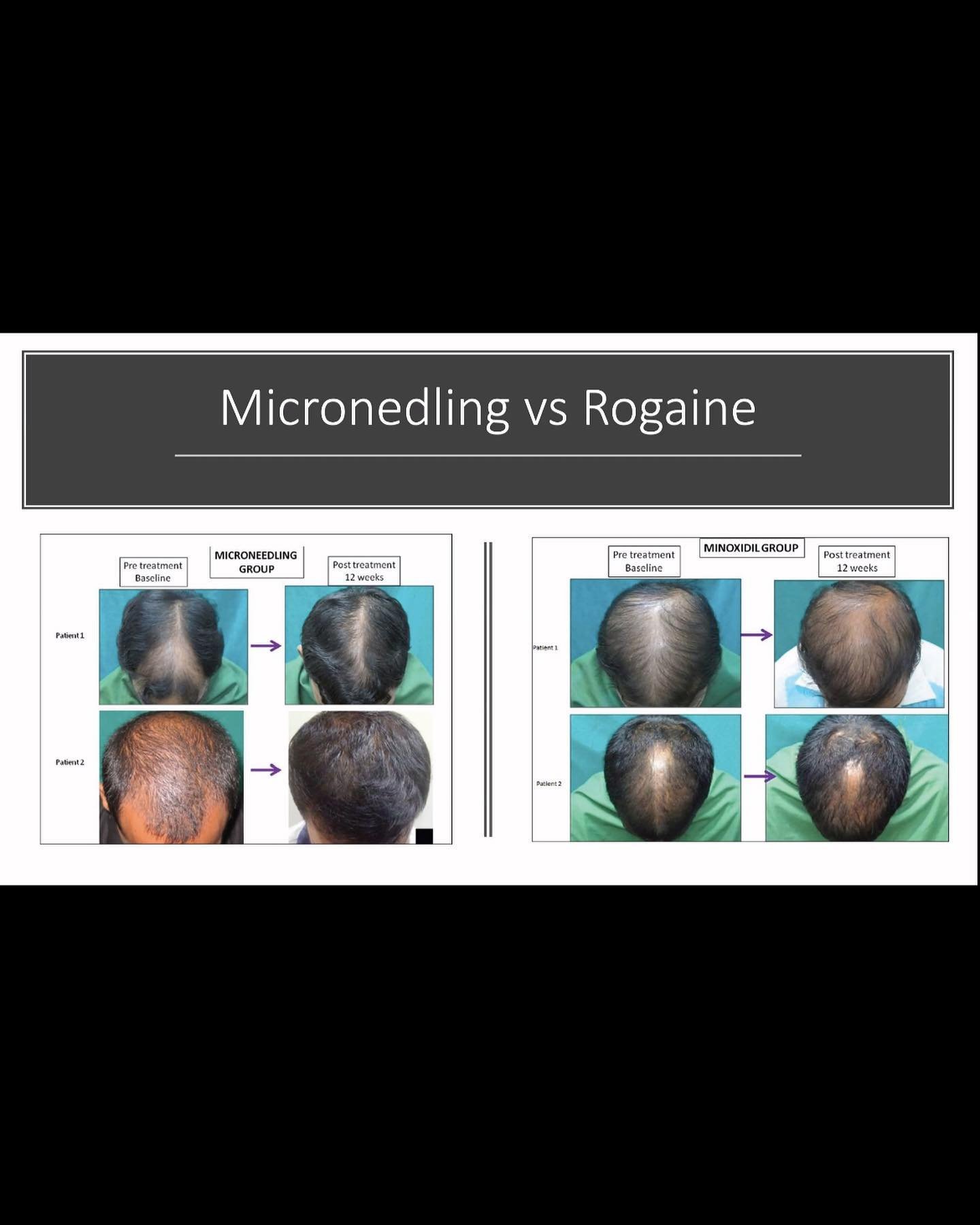 Natural hair growth programs offered at Natural Pathways.