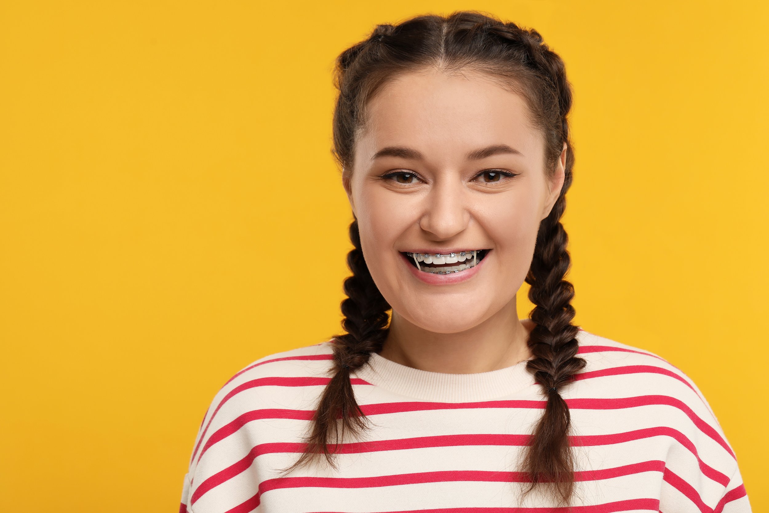 Does Everyone With Braces Need to Wear Elastics?