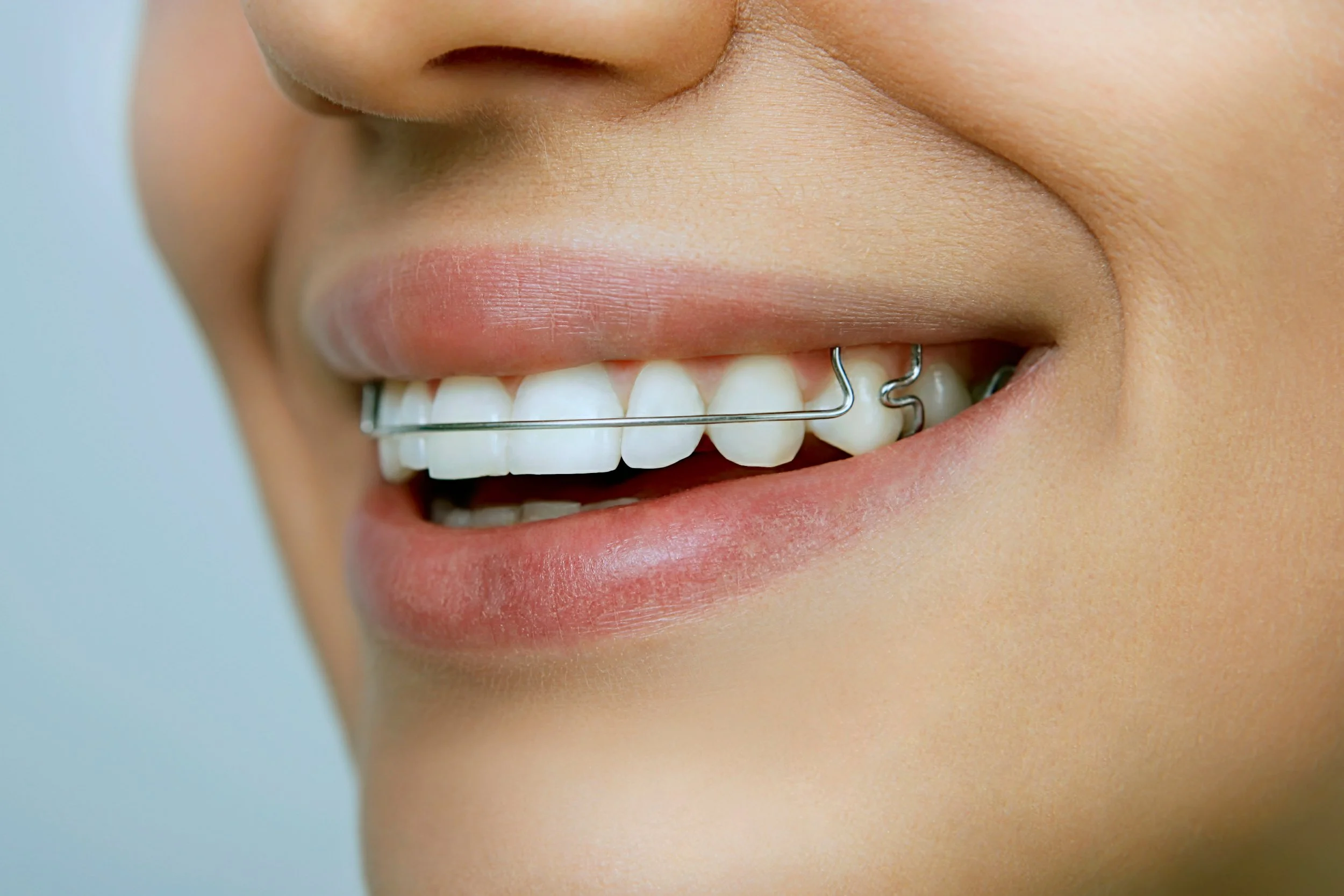 How Do I Maintain My Retainer?