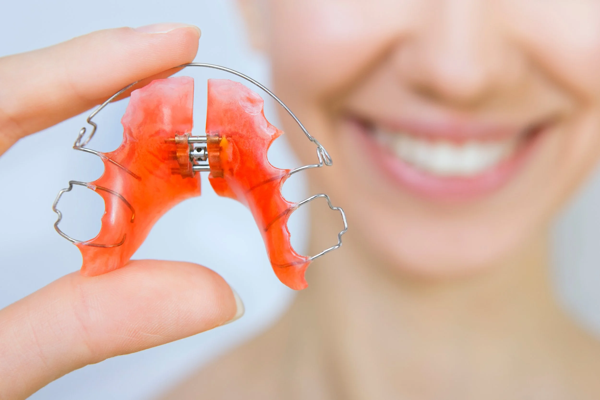 What Should I Do If I Lose or Damage My Retainer?