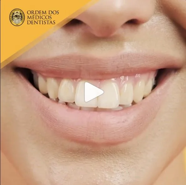 Recomendação da OMD - Não ponhas nada no teu sorriso sem consultar o teu médico dentista