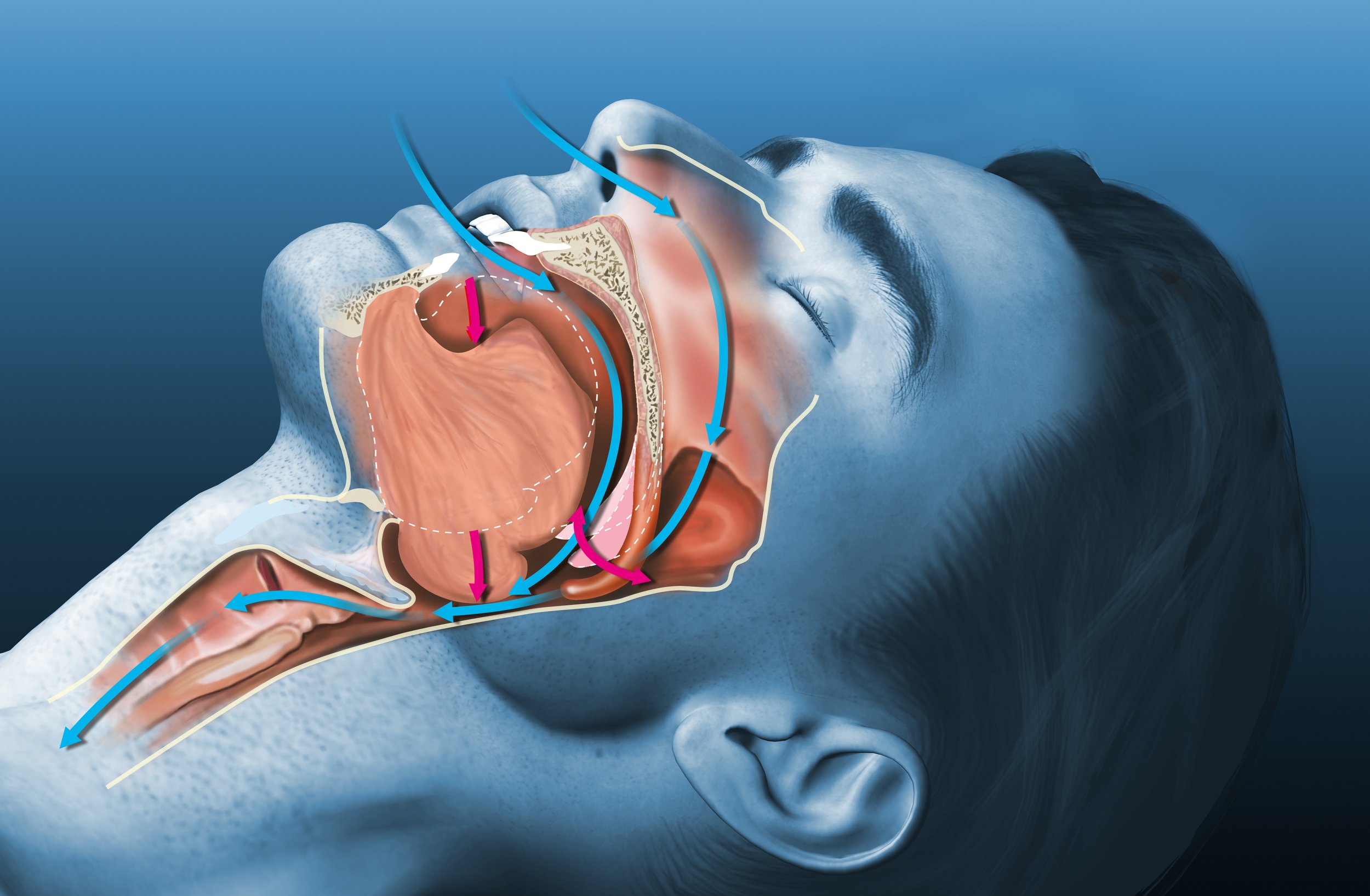medical illustration of breathing and airway to show how airway focused dentistry at Liberty HIll Dental can provide outstanding benefits
