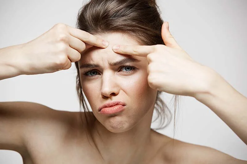June is National Acne Awareness Month