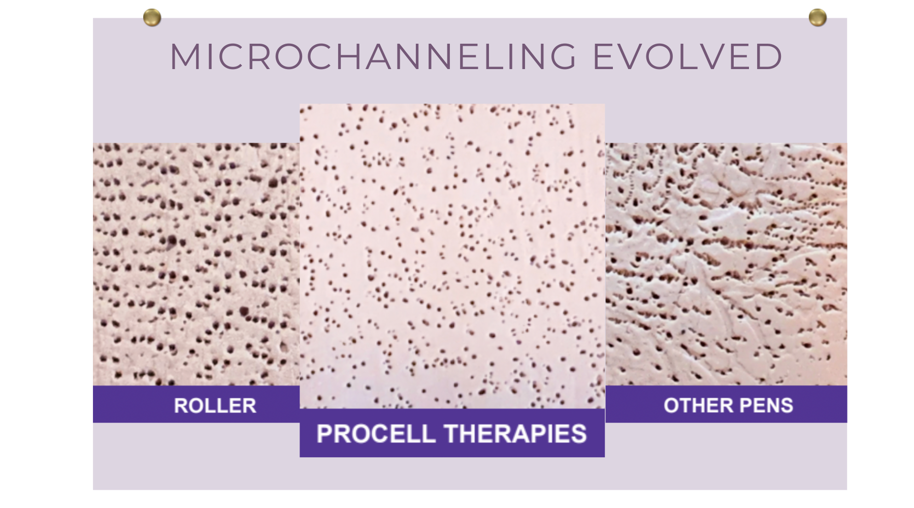 Procell Microcurrent Background Look Years Younger Instantly - Discover the Benefits of Procell ...