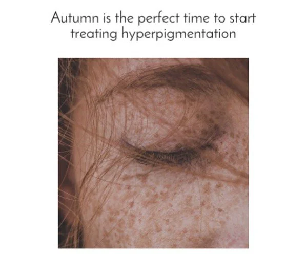 #skin #skintreatment #skincare #skinclinic #microneedling #skinpeels #sundamage #hyperpigmentation #skinconfidence