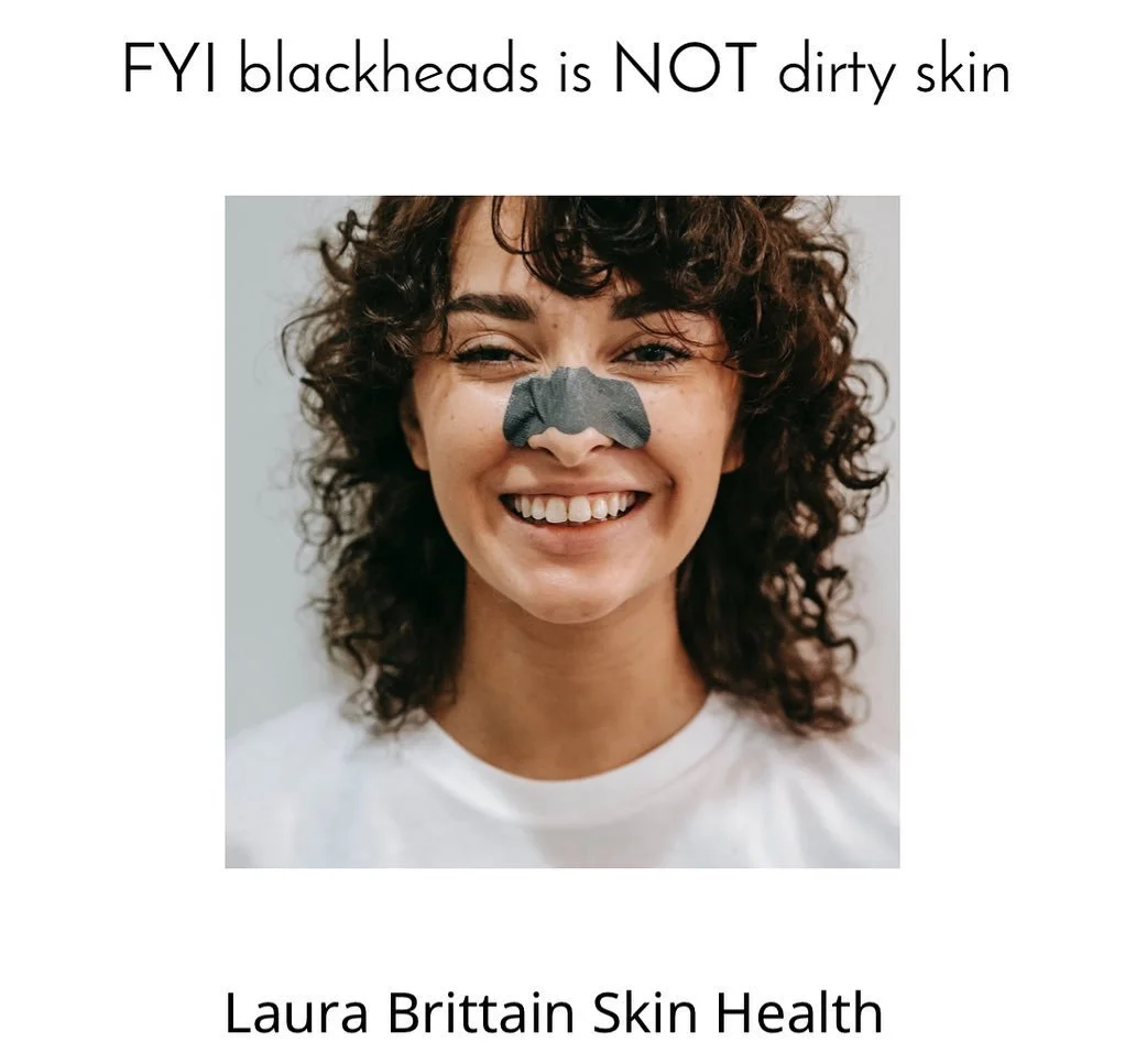 #skin #skinhealth #blackheads #skincare #skinclinic #acne #chemicalpeel #ledlighttherapy