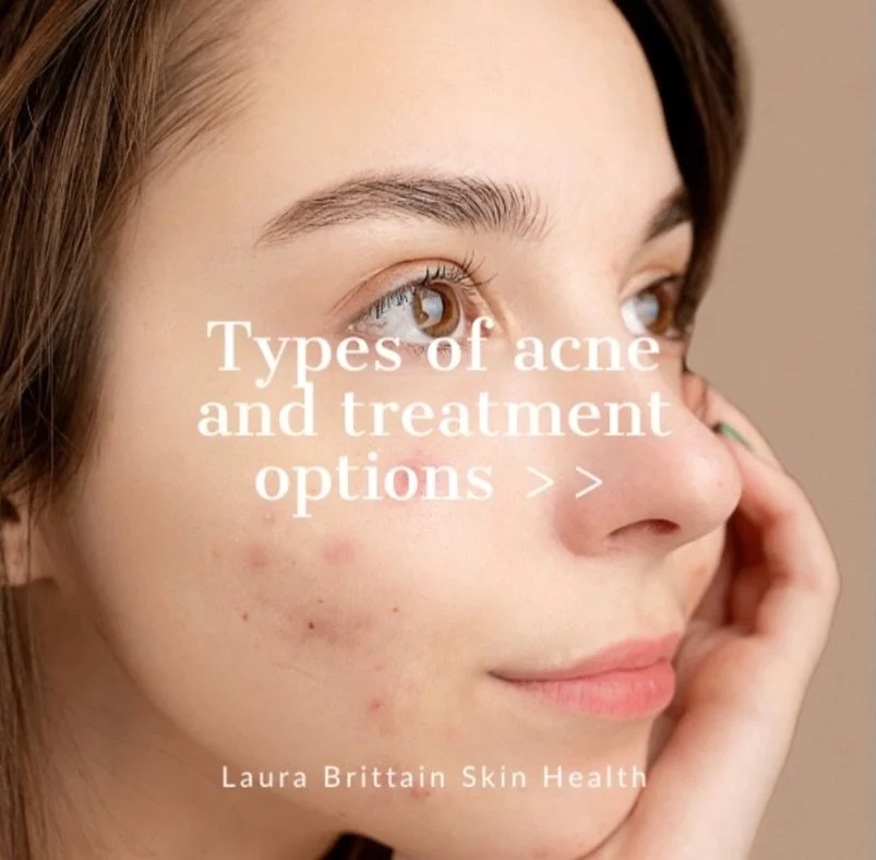 Types of Acne and treatment options.

#skin #skinhealth #acne #acneproneskin #acnetreatment