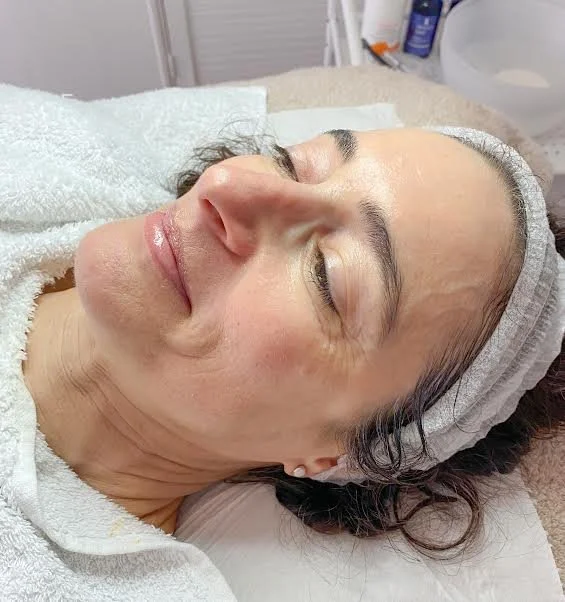 AFTER - having regular facial and enzyme peels the skin looks much more brighter with softened fine lines and wrinkles
