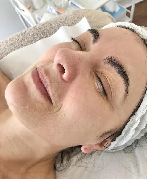 BEFORE - Clients skin concerns was dullness, ageing and uneven texture