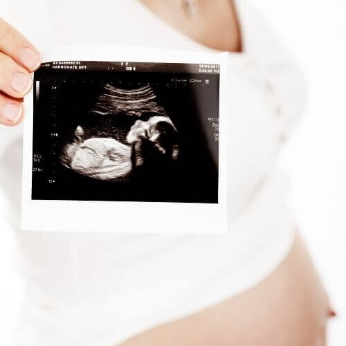 Ultrasound-Baby-Journal-Ideas.jpg