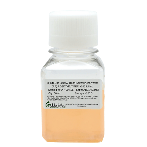 RF Positive Plasma Titer >200