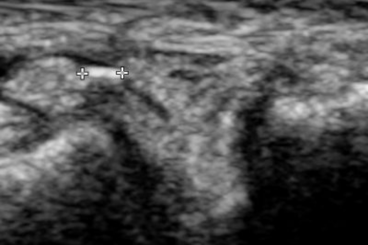 The ankle 3: consider the foot?