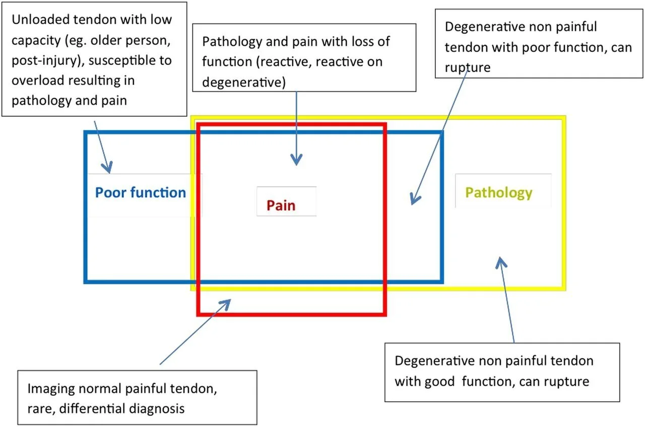How to tendinopathy: 2