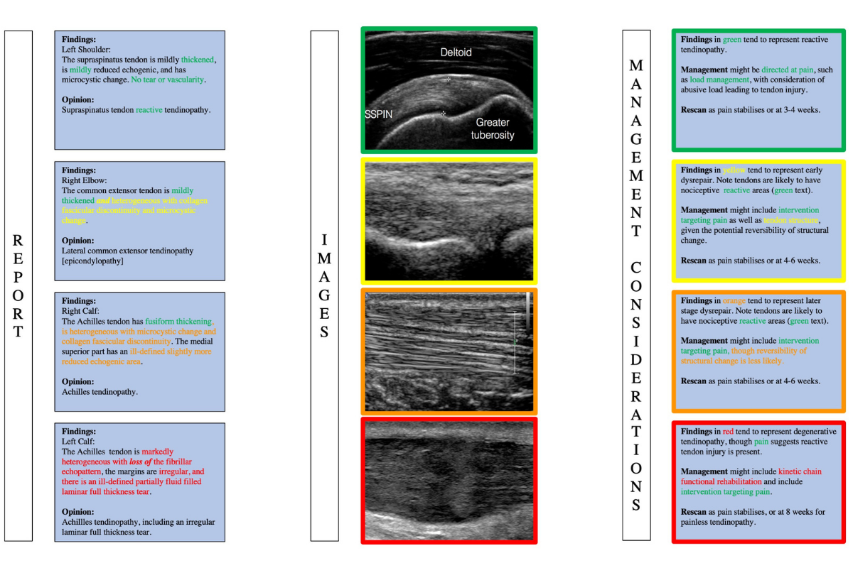 How to tendinopathy 3: using the ultrasound report
