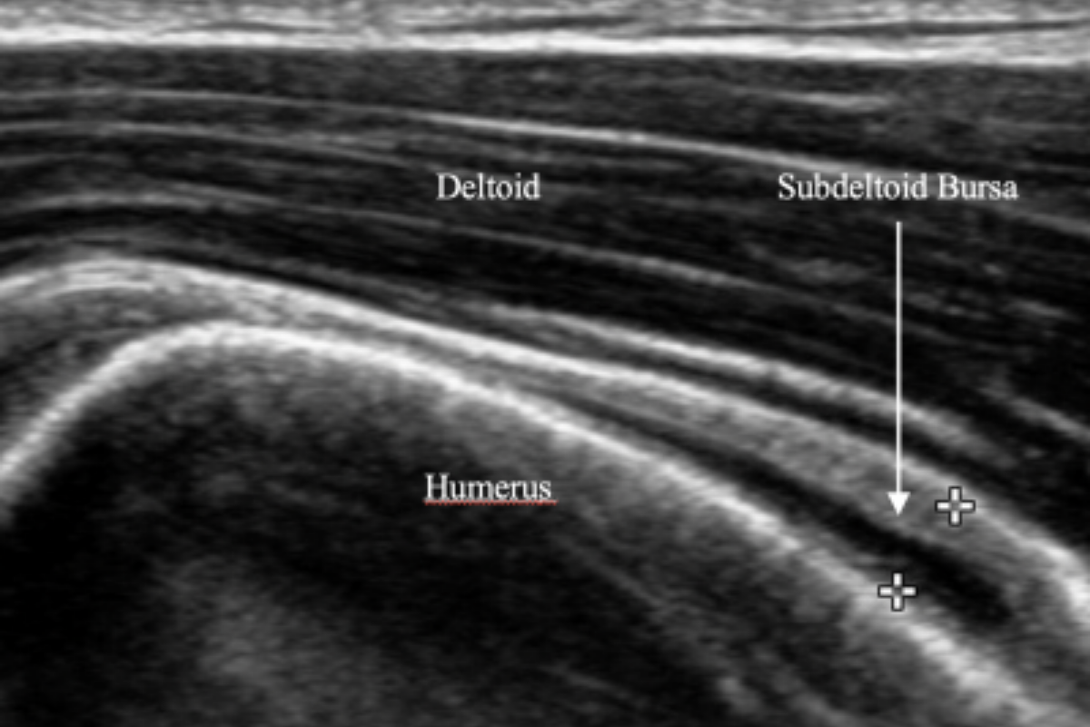 Shoulder pain 1: remember the exceptions
