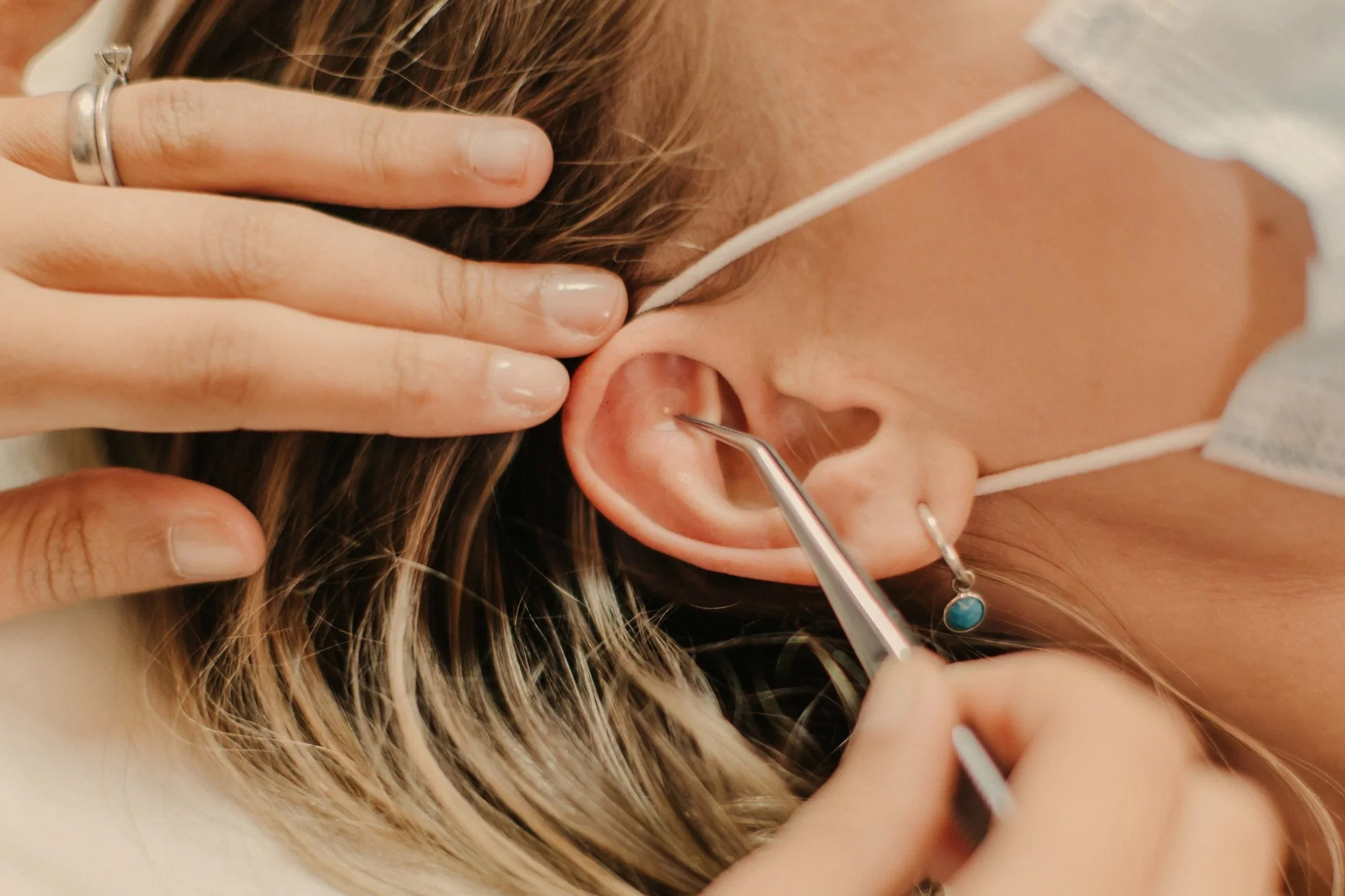 Acupressure ear seeds