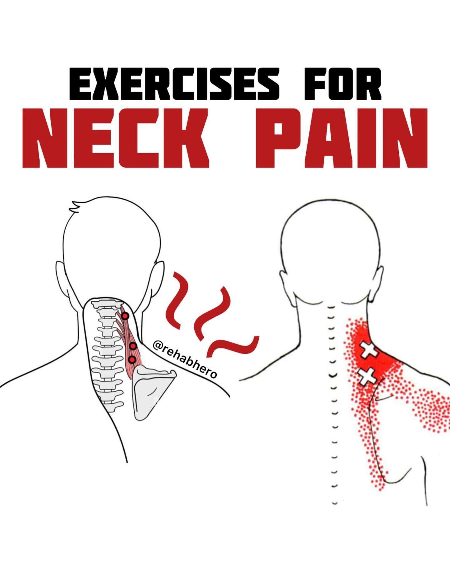 💢NECK PAIN RELIEF💢

Got neck pain issues? One of the best things you can do is to start doing deep neck flexor endurance and neck strengthening exercises, and you can do it from the comfort of your own home. Why does this work?

Among the different