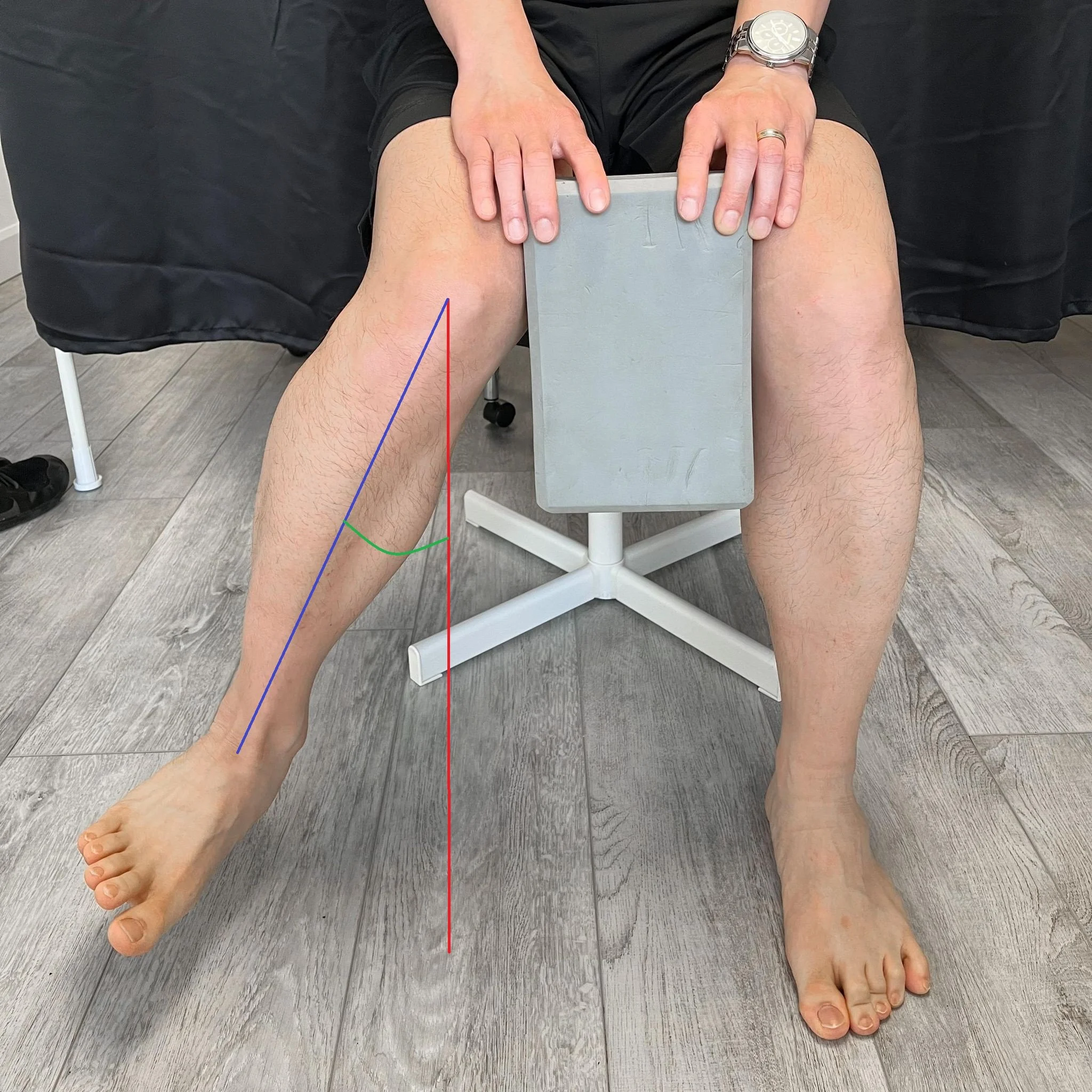 Squat Mobility — Rehab Hero