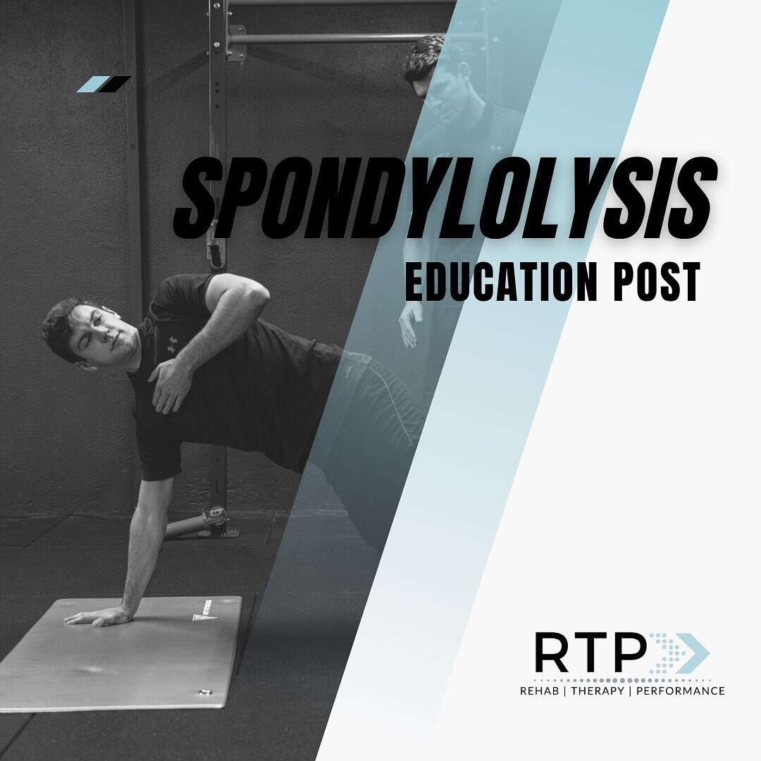 Education Post - Spondylolysis