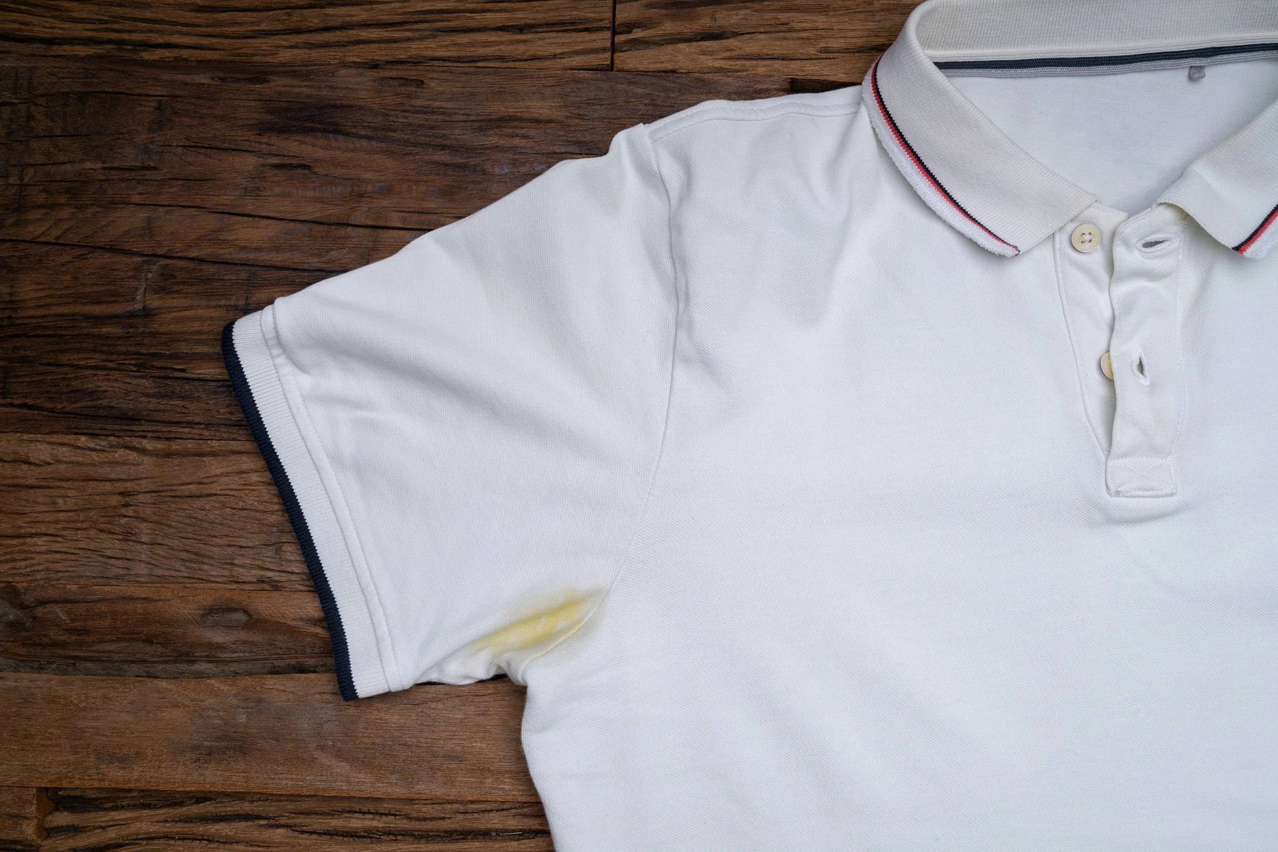 What's Causing Those Yellow Stains on Your White Clothes?