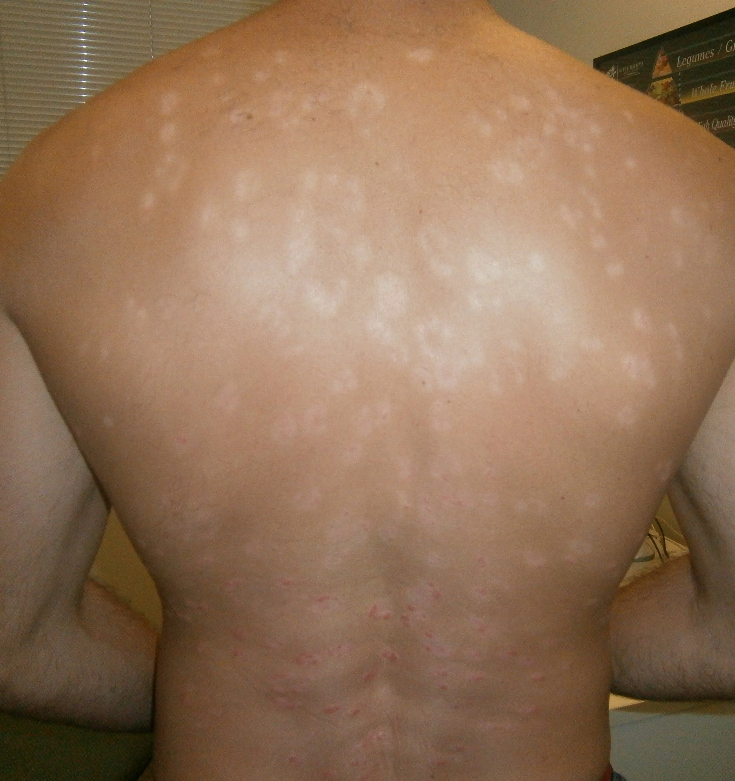 After back.jpg