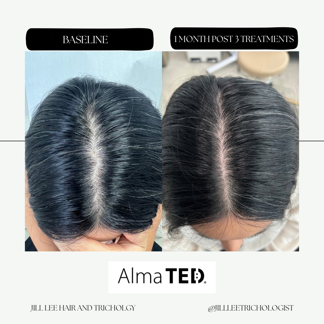 Elegant Neutral This or That Comparison Instagram Post - 6.PNG