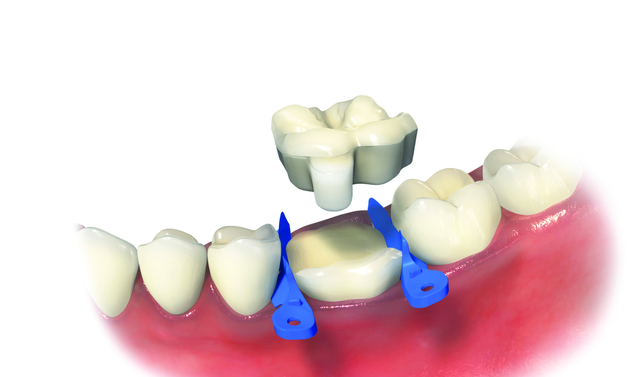 ovc-dentist-brochure-distributor-v1_page_1_image_0001.png
