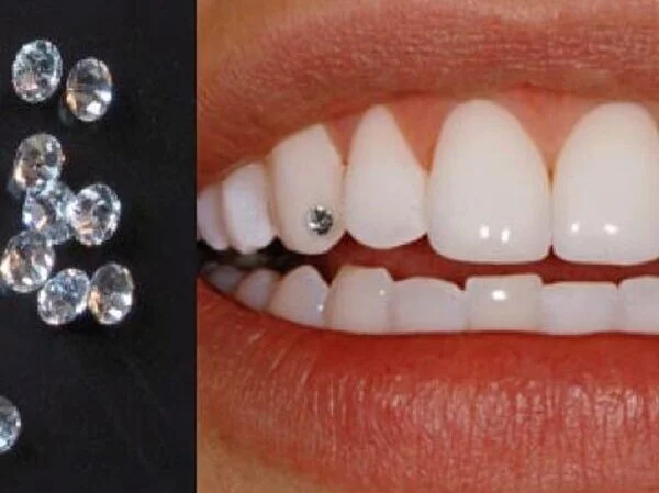 teeth-jewel.jpg