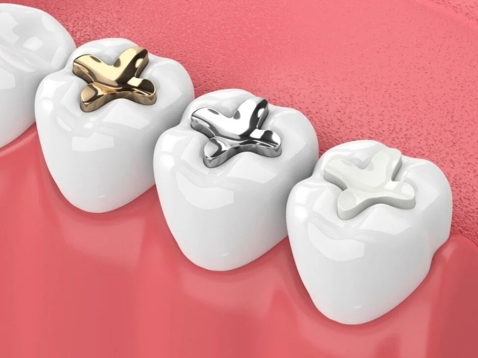 Fillings